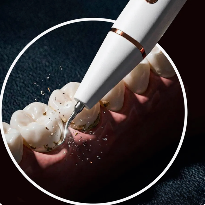 GlowSmile™ – Ultralydrengjøring