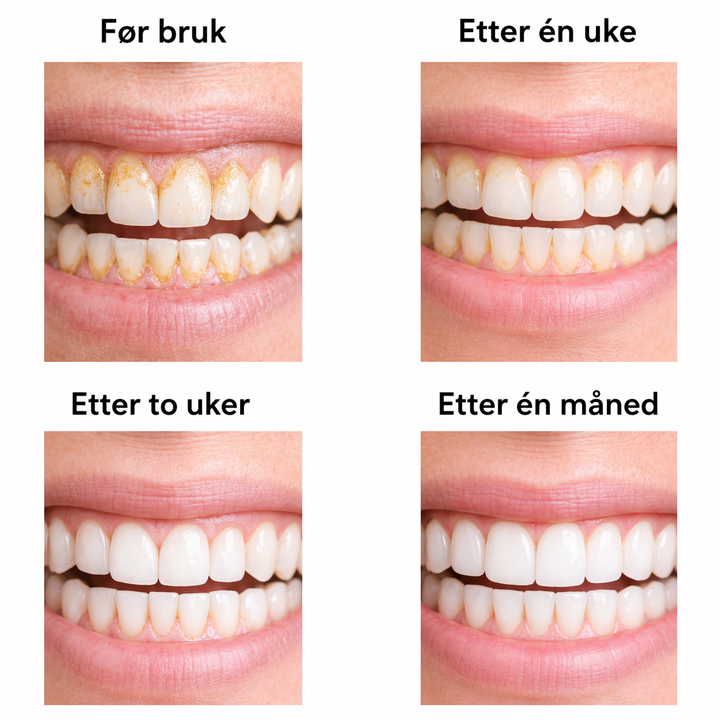 GlowSmile™ – Ultralydrengjøring